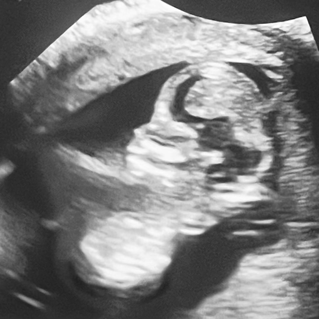 Photo shared by Daisy Marina for their Babylist baby registry.