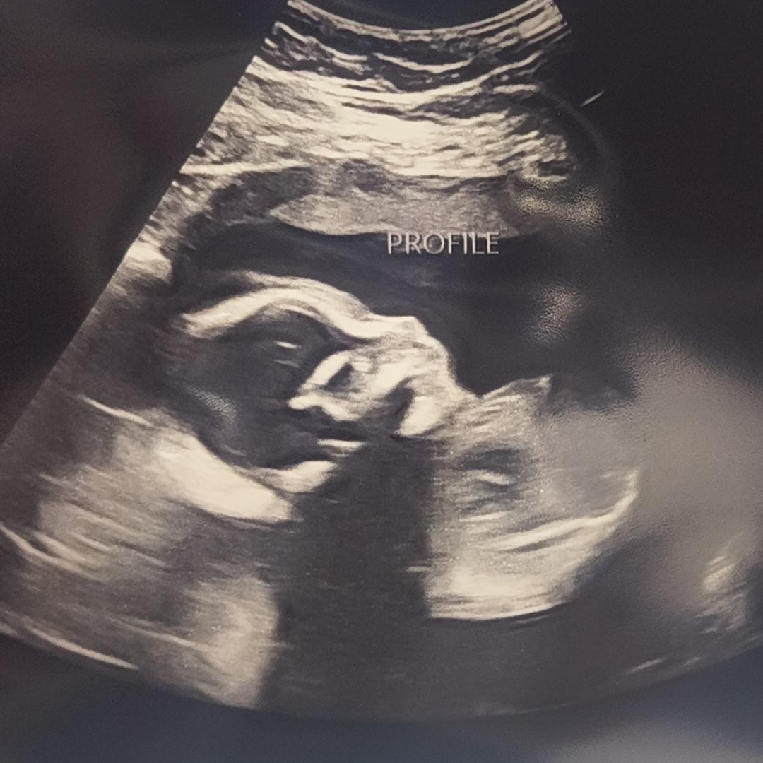 Photo shared by Valerie for their Babylist baby registry.