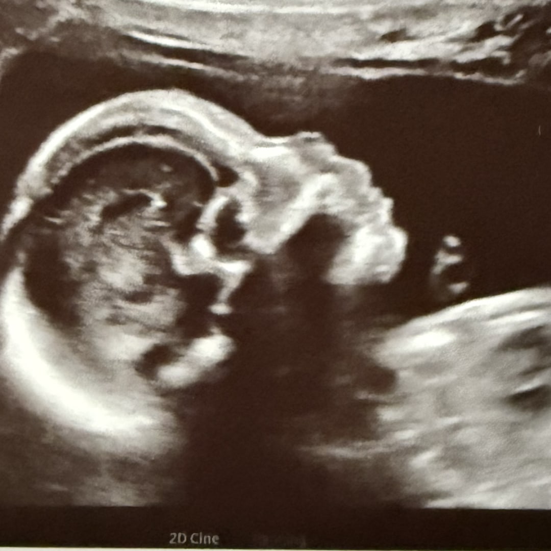 Photo shared by Mya for their Babylist baby registry.