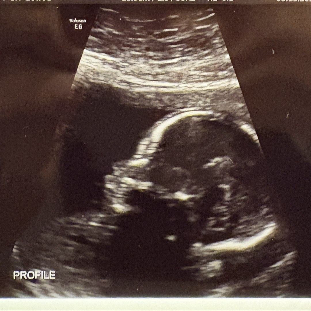 Photo shared by Sarah Jessica for their Babylist baby registry.