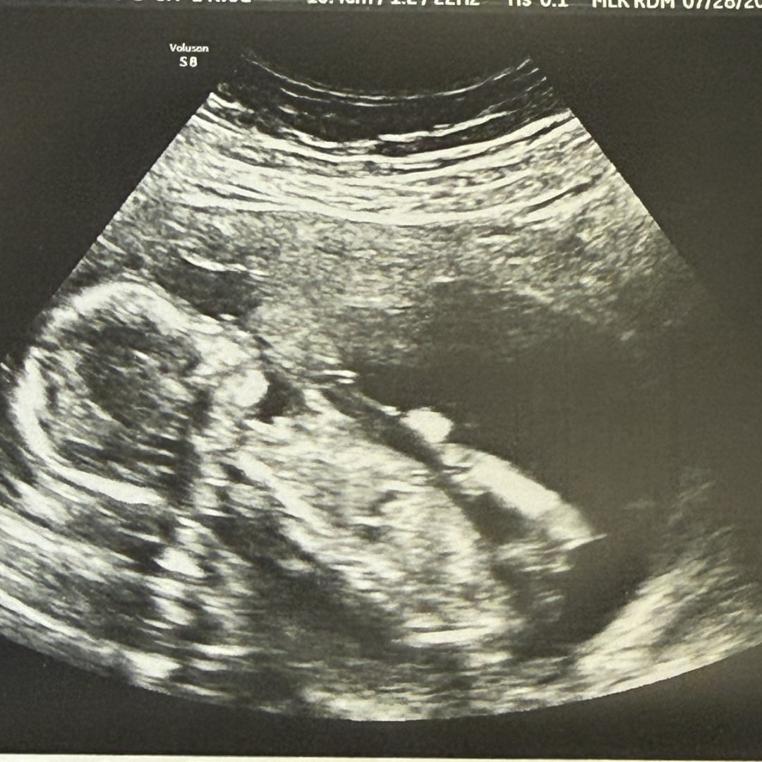 Photo shared by Hannah for their Babylist baby registry.