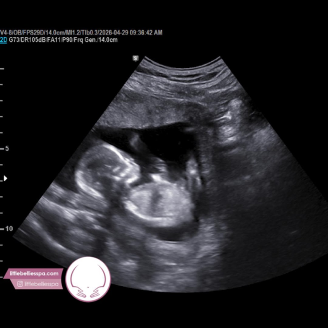 Photo shared by Mari for their Babylist baby registry.