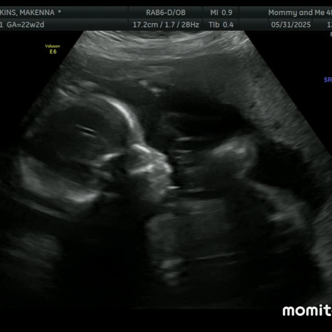 Photo shared by Kaitlyn for their Babylist baby registry.