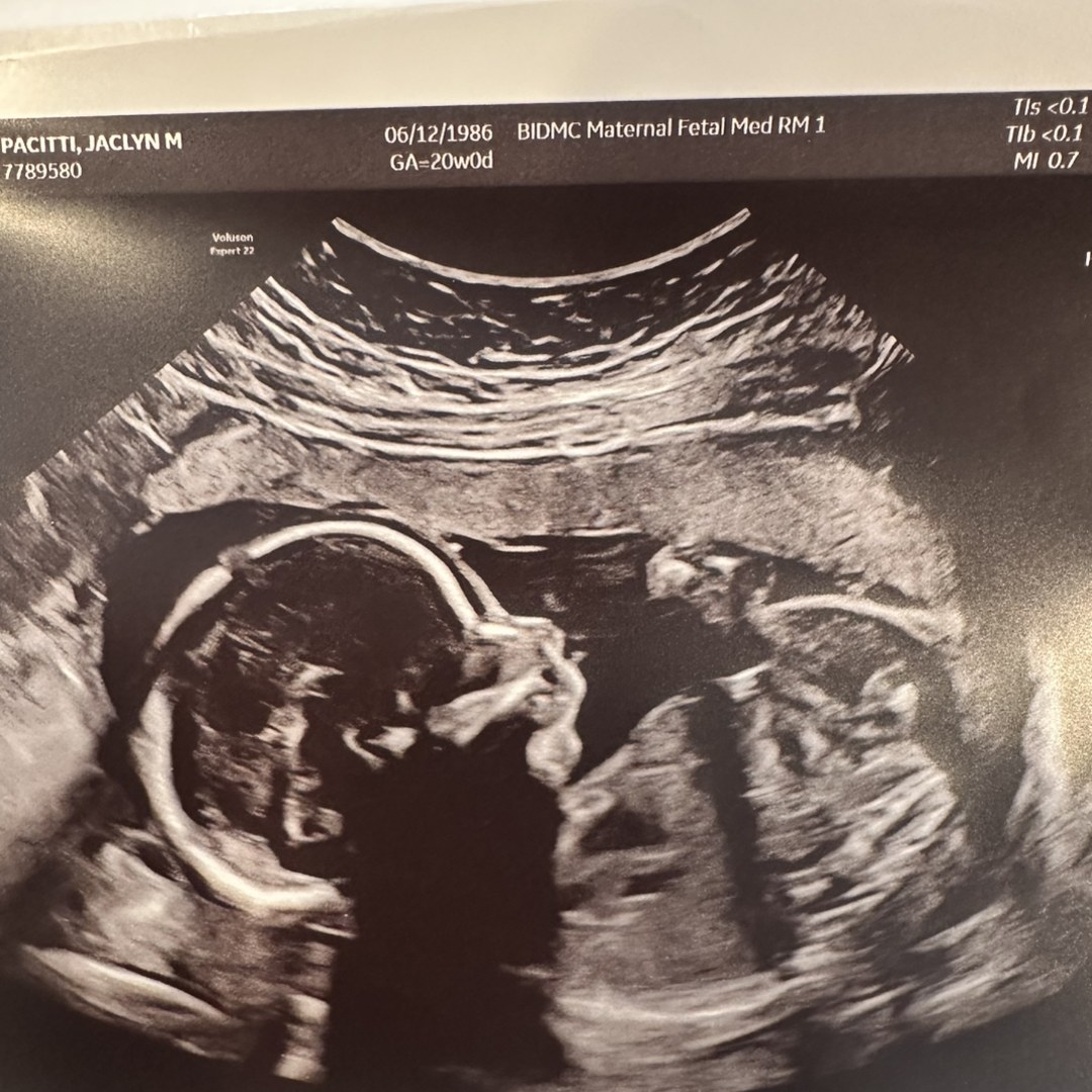 Photo shared by Jaclyn for their Babylist baby registry.