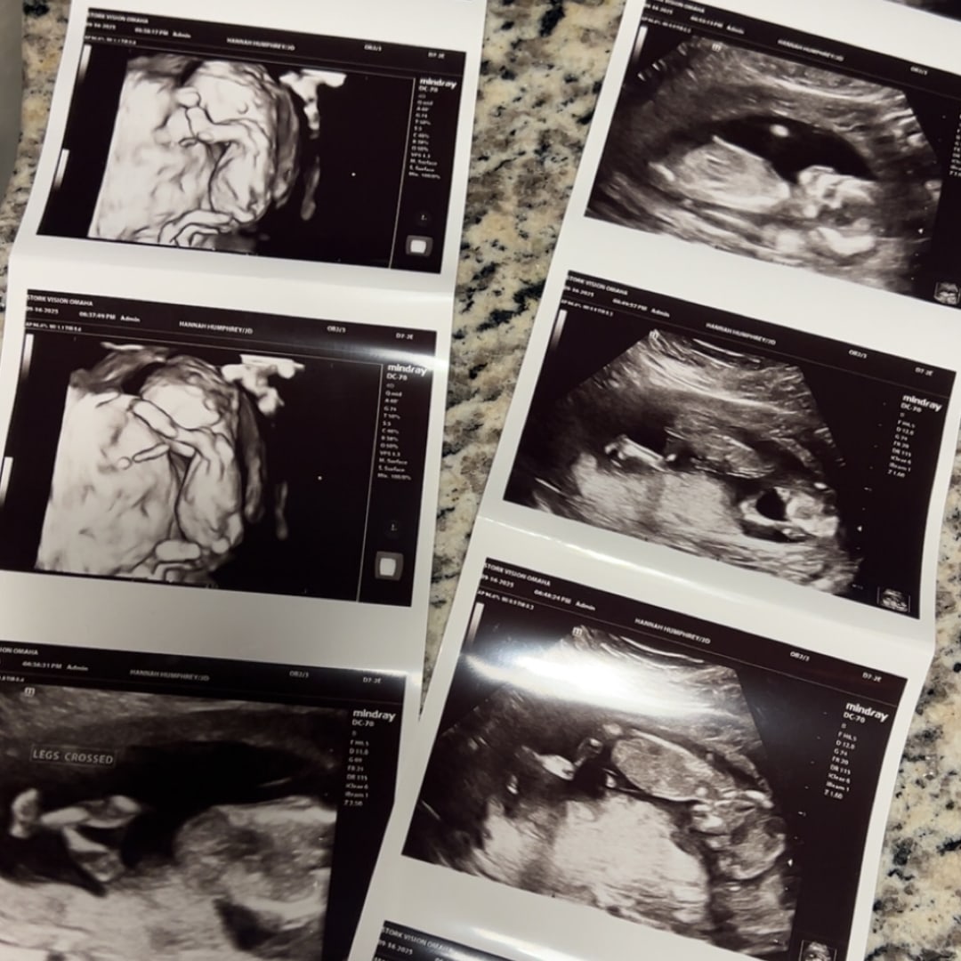 Photo shared by Hannah for their Babylist baby registry.