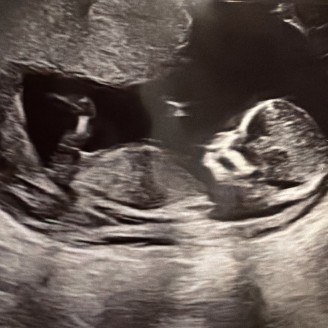 Photo shared by Alyssa for their Babylist baby registry.