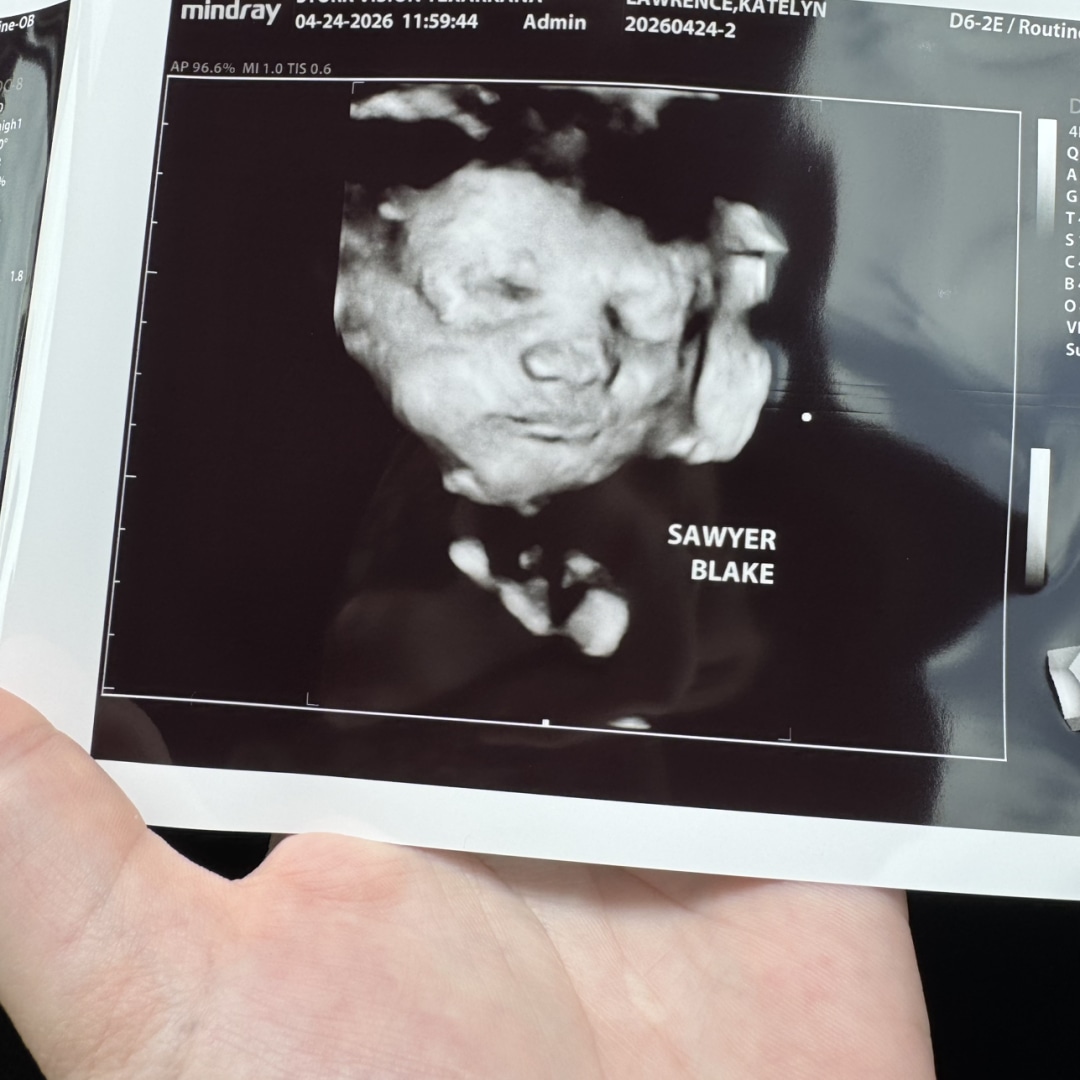Photo shared by Katie for their Babylist baby registry.