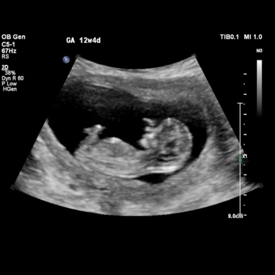 Photo shared by Kristina for their Babylist baby registry.