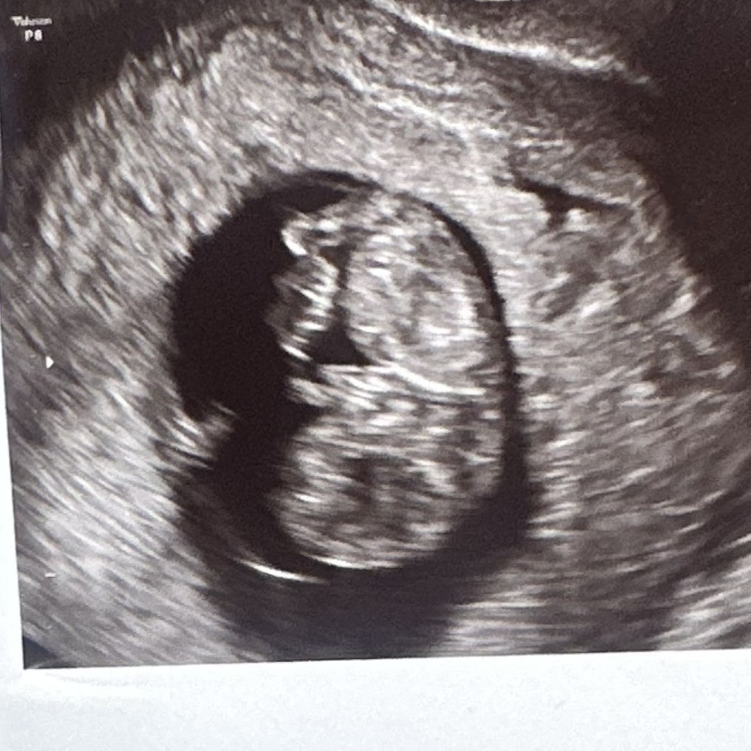 Photo shared by Alli for their Babylist baby registry.