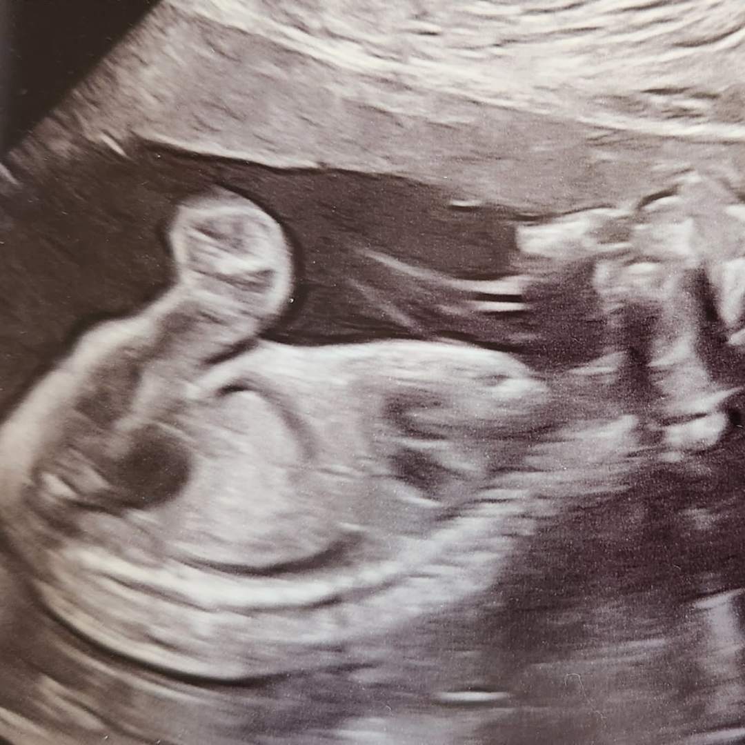 Photo shared by CarolAnn for their Babylist baby registry.