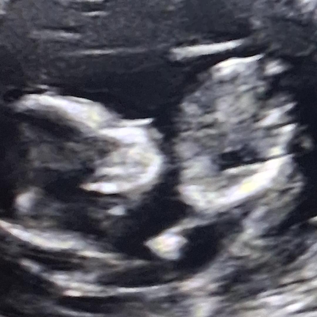 Photo shared by Angelica for their Babylist baby registry.