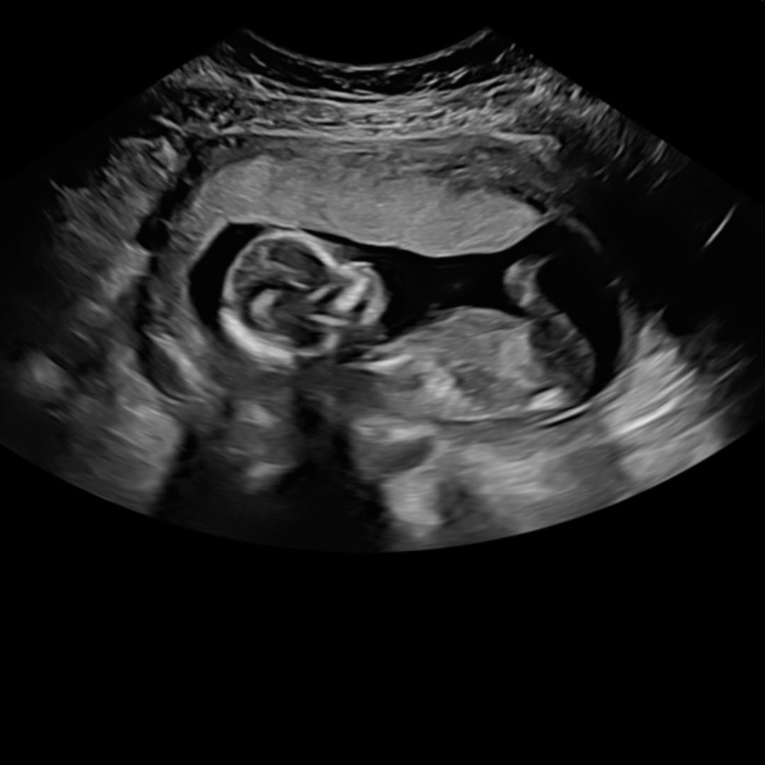 Photo shared by Alexis for their Babylist baby registry.