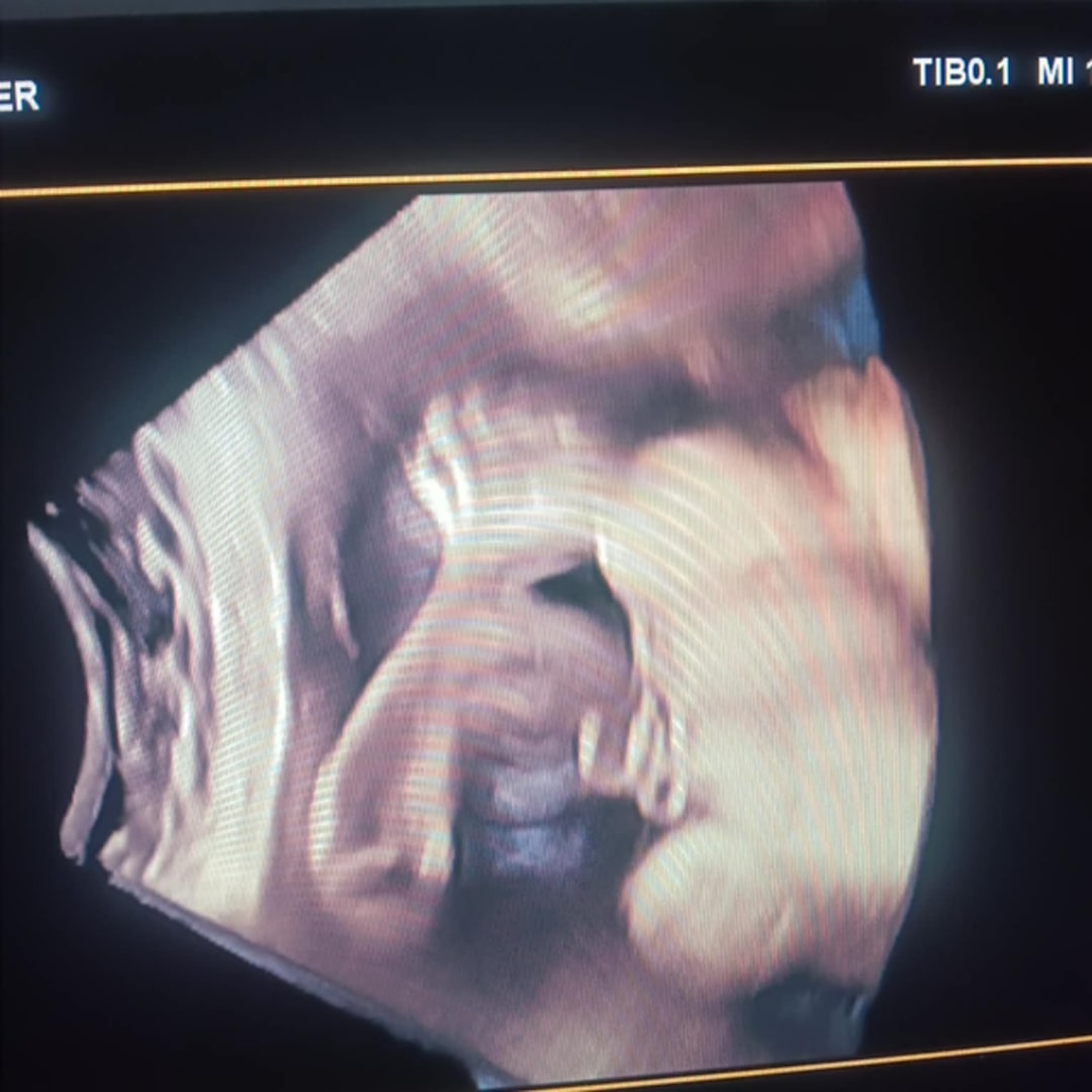 Photo shared by Gretchan for their Babylist baby registry.