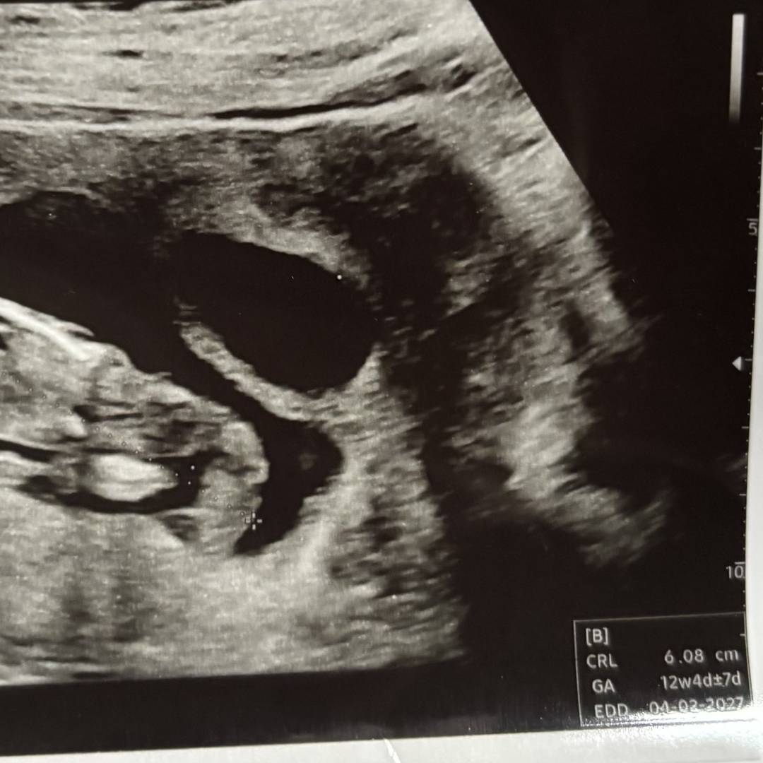 Photo shared by Danielle for their Babylist baby registry.