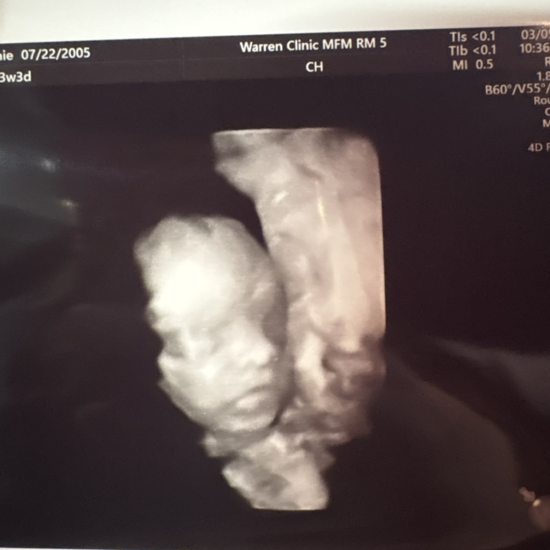 Photo shared by Stephanie for their Babylist baby registry.