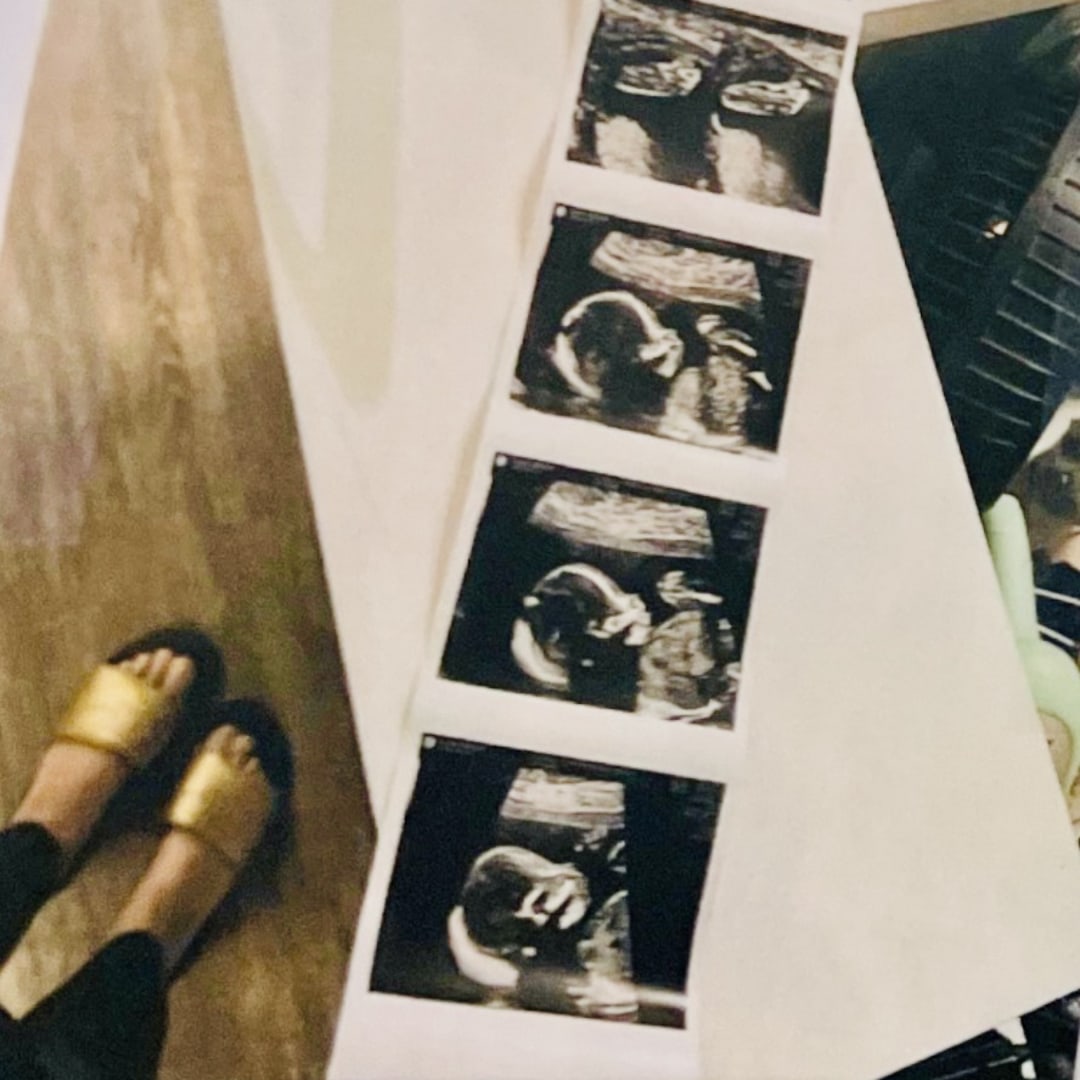 Photo shared by Cheline for their Babylist baby registry.