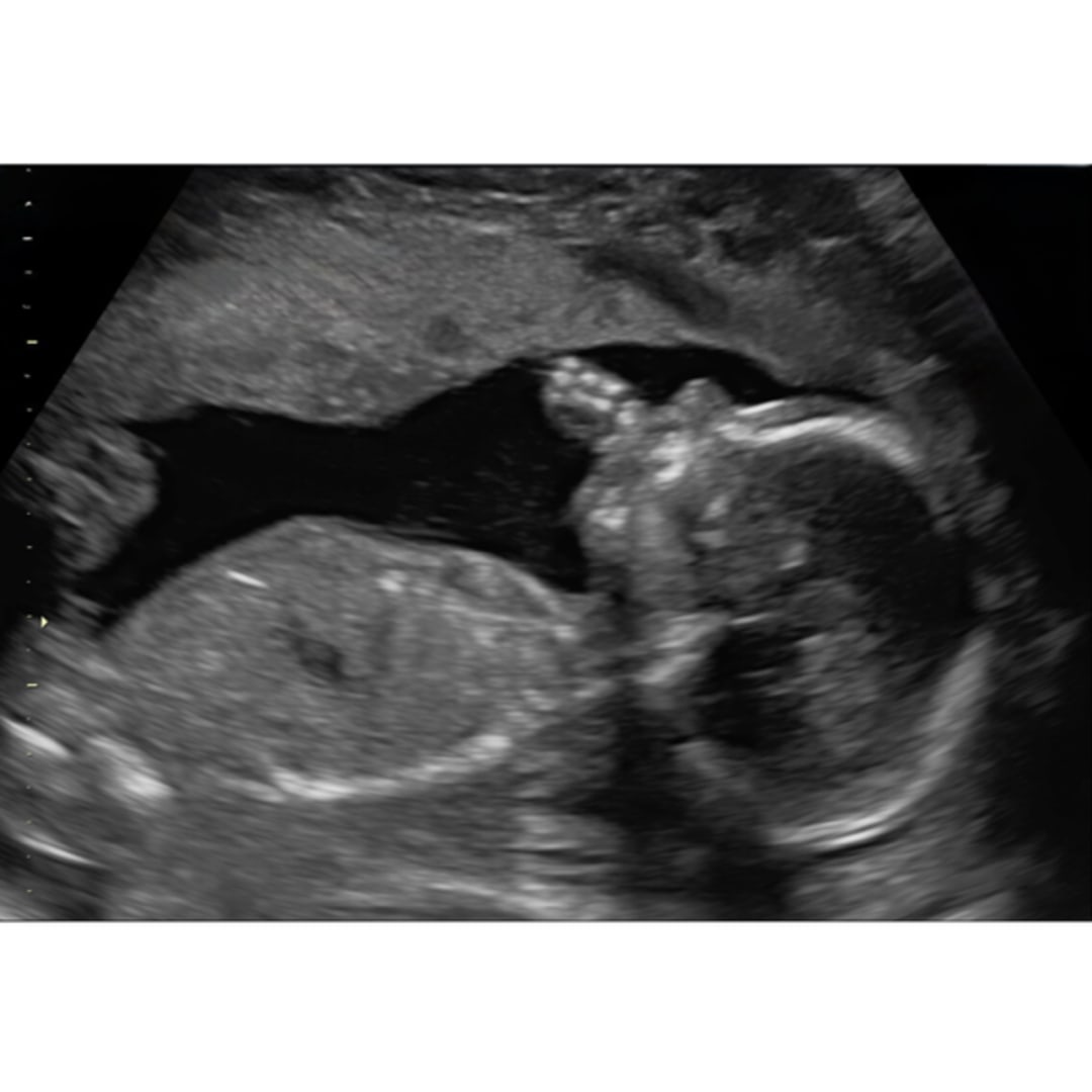 Photo shared by Julie for their Babylist baby registry.