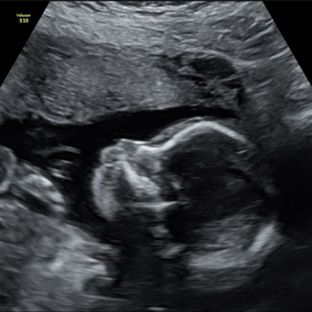Photo shared by Karina for their Babylist baby registry.