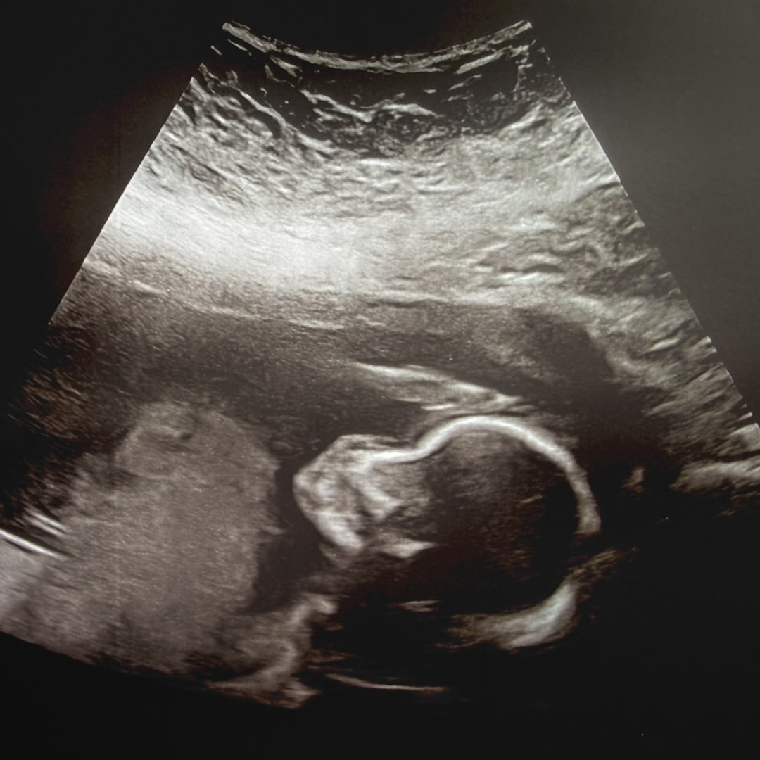 Photo shared by Vanessa for their Babylist baby registry.