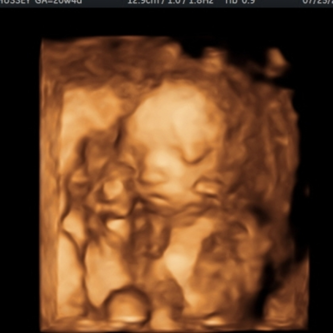 Photo shared by Harleigh for their Babylist baby registry.