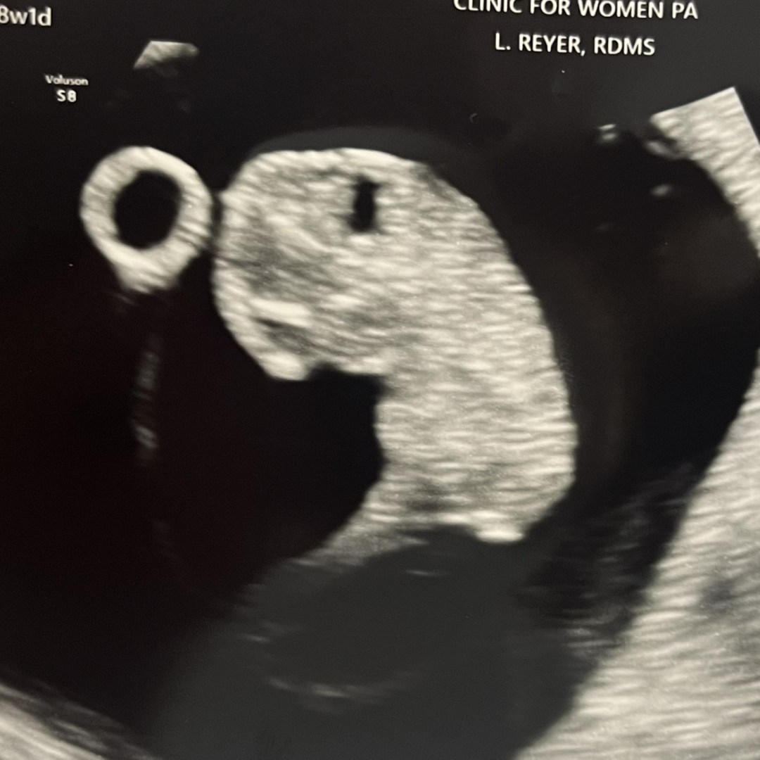 Photo shared by Kathryn for their Babylist baby registry.