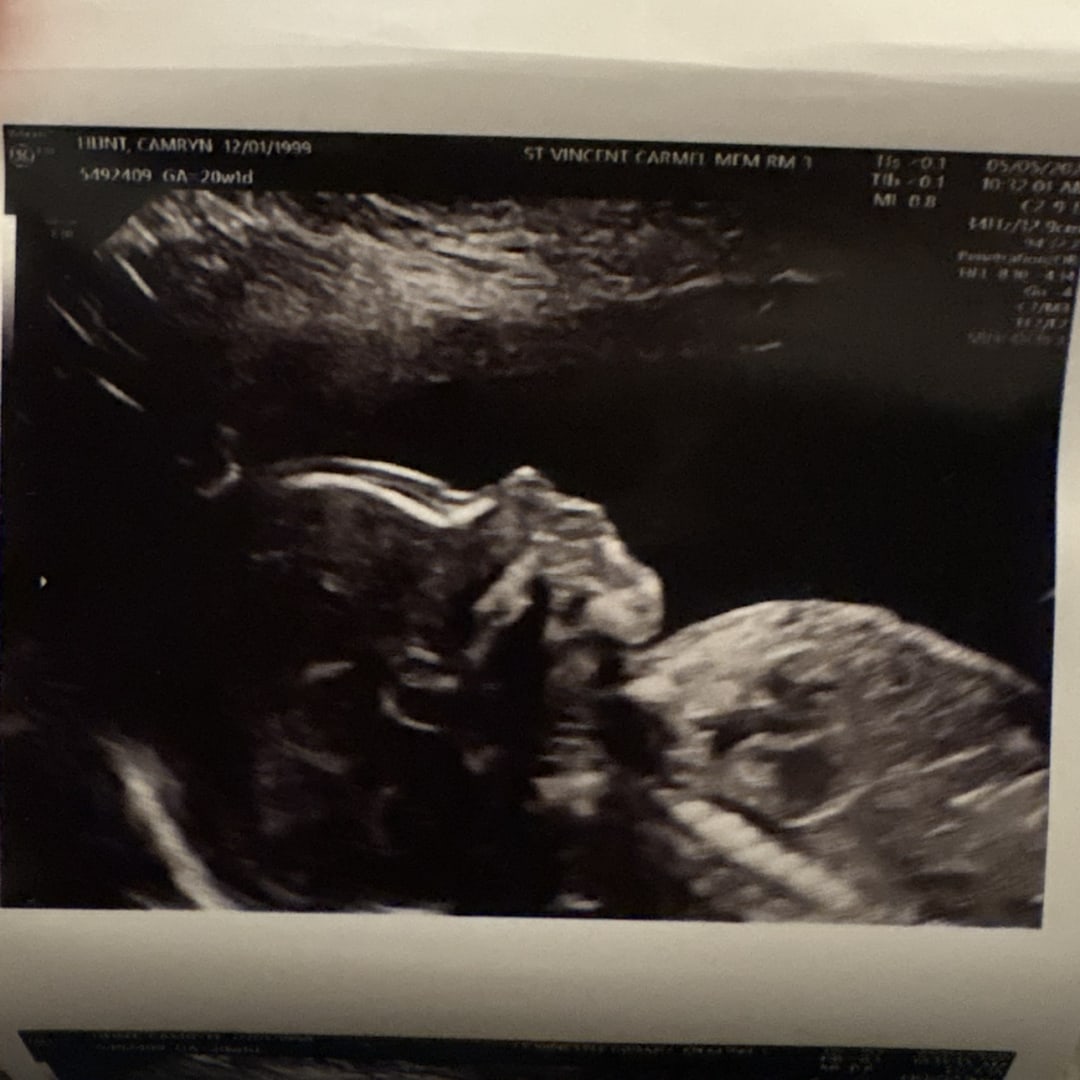 Photo shared by Camryn for their Babylist baby registry.