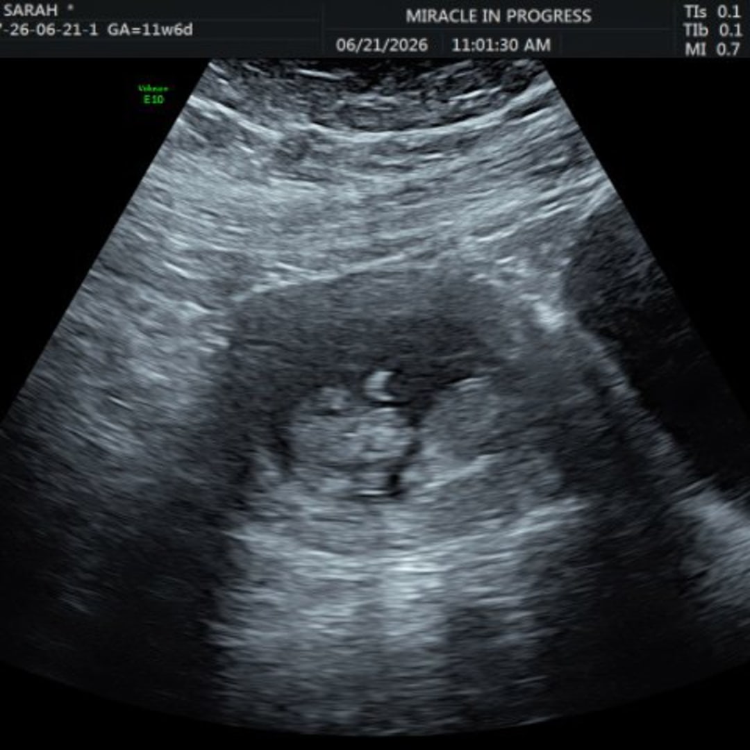 Photo shared by Sarah for their Babylist baby registry.