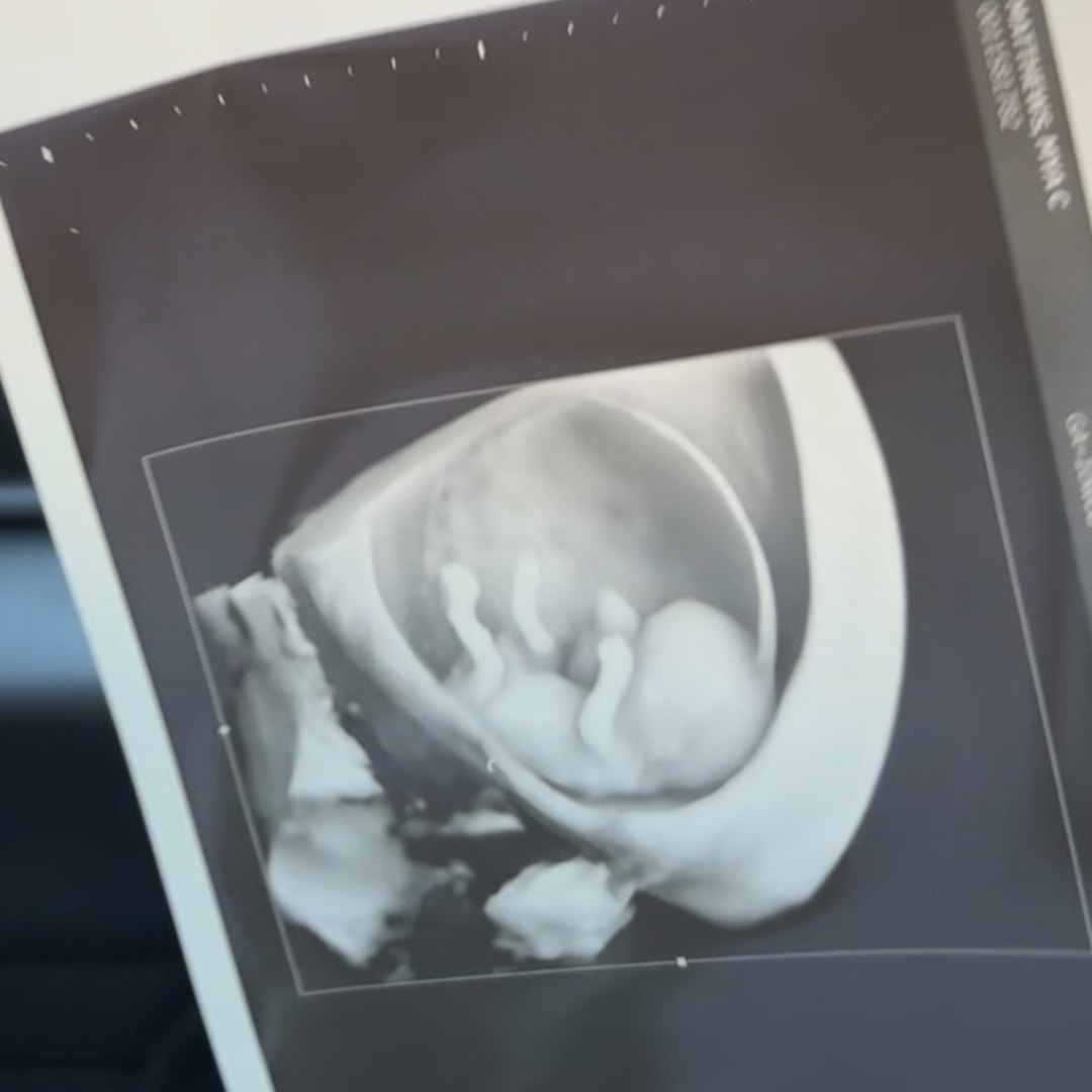 Photo shared by Mya for their Babylist baby registry.