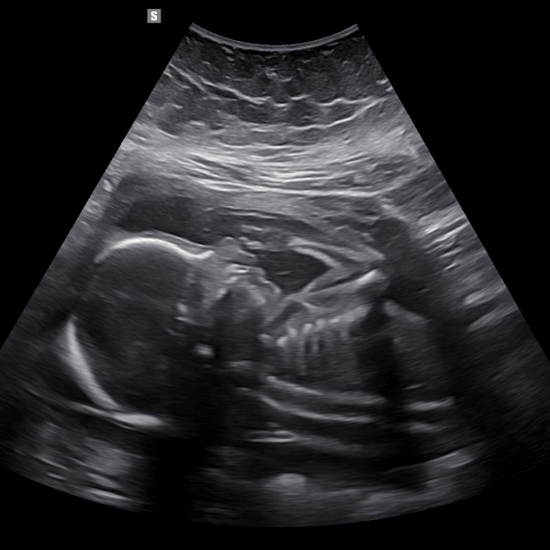 Photo shared by Lindsay for their Babylist baby registry.