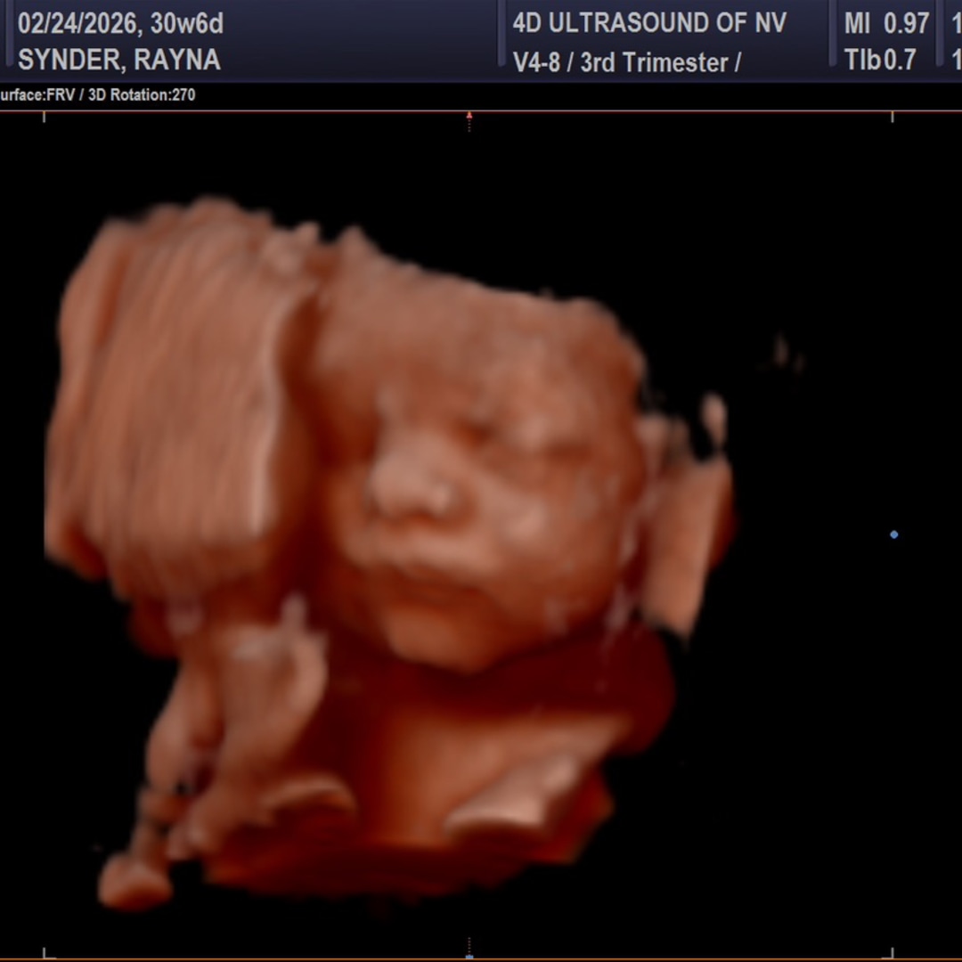 Photo shared by Rayna for their Babylist baby registry.