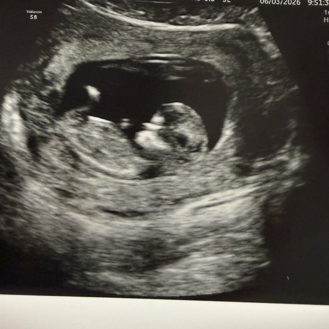 Photo shared by Brie-ann for their Babylist baby registry.