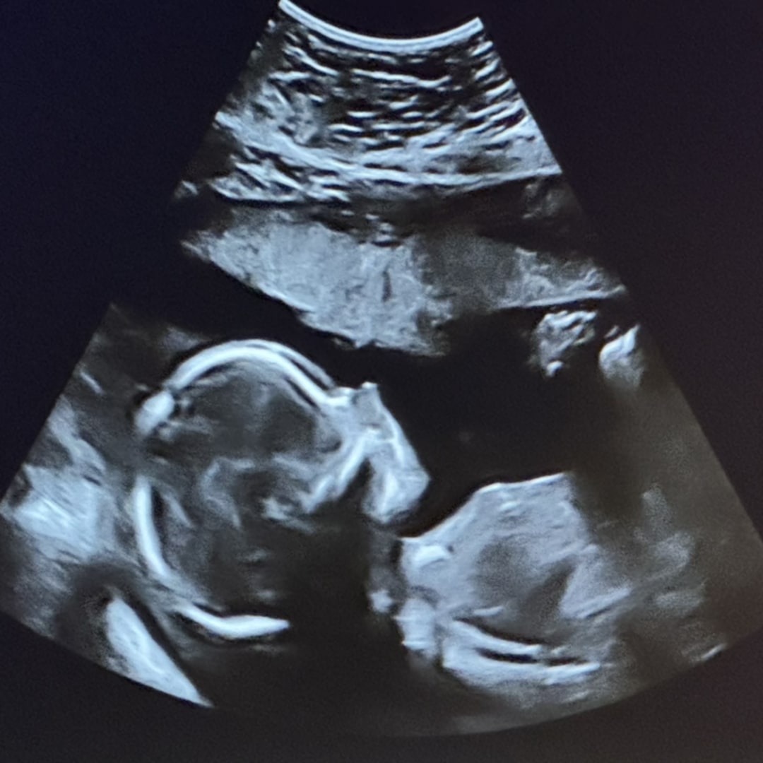 Photo shared by Anna for their Babylist baby registry.