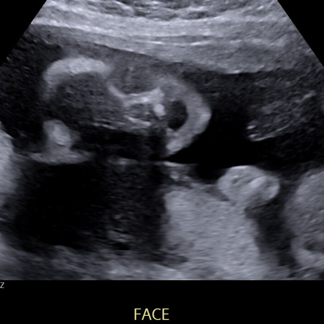 Photo shared by Whitney for their Babylist baby registry.