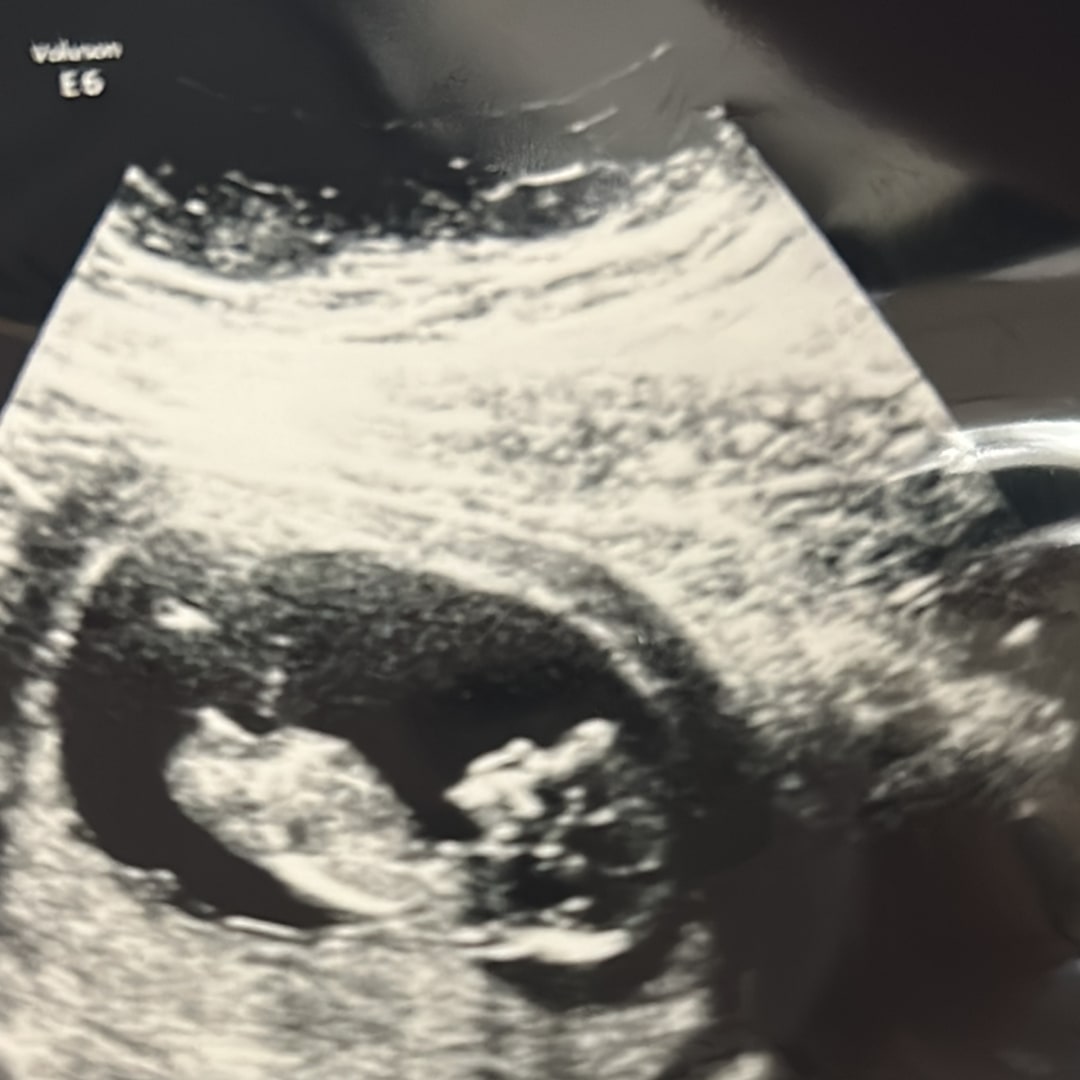Photo shared by Karolann for their Babylist baby registry.