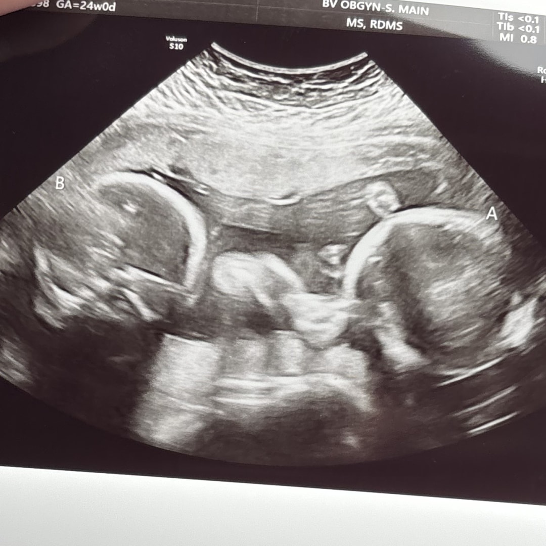 Photo shared by Abbey for their Babylist baby registry.