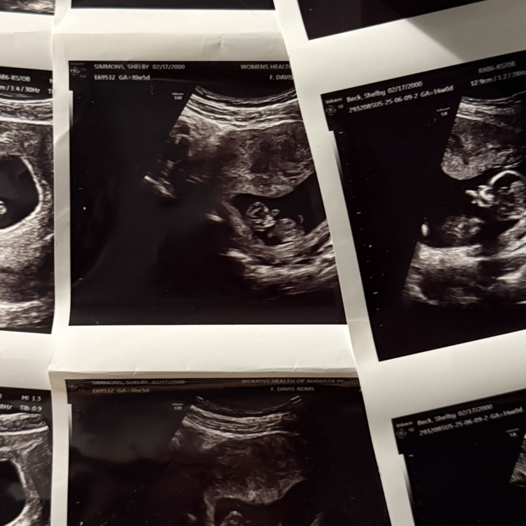 Photo shared by Shelby for their Babylist baby registry.