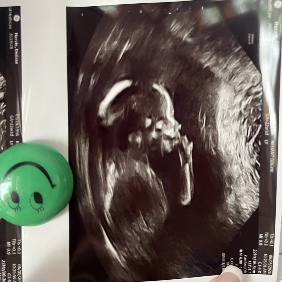 Photo shared by Desirae for their Babylist baby registry.
