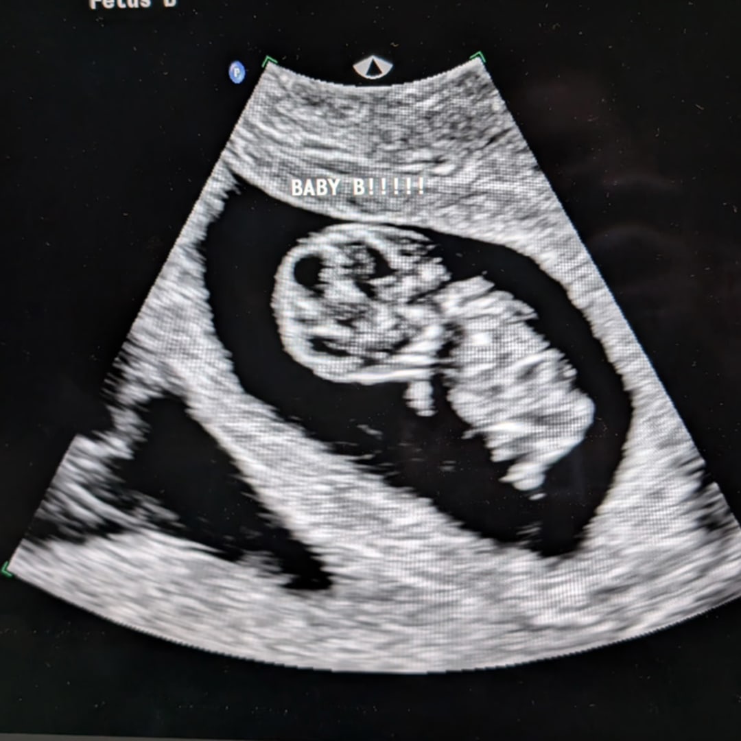 Photo shared by Jill for their Babylist baby registry.