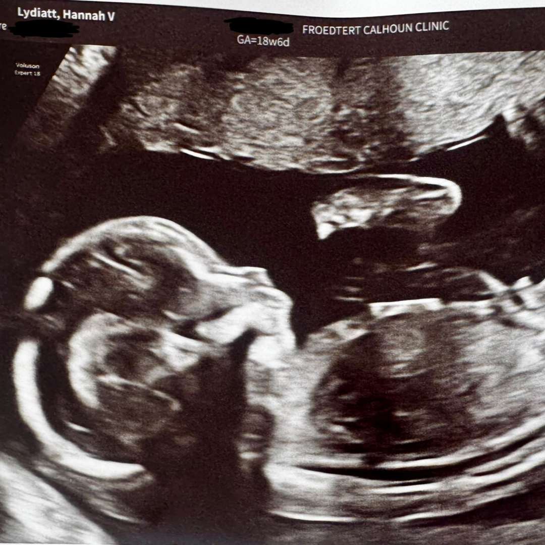 Photo shared by Hannah for their Babylist baby registry.