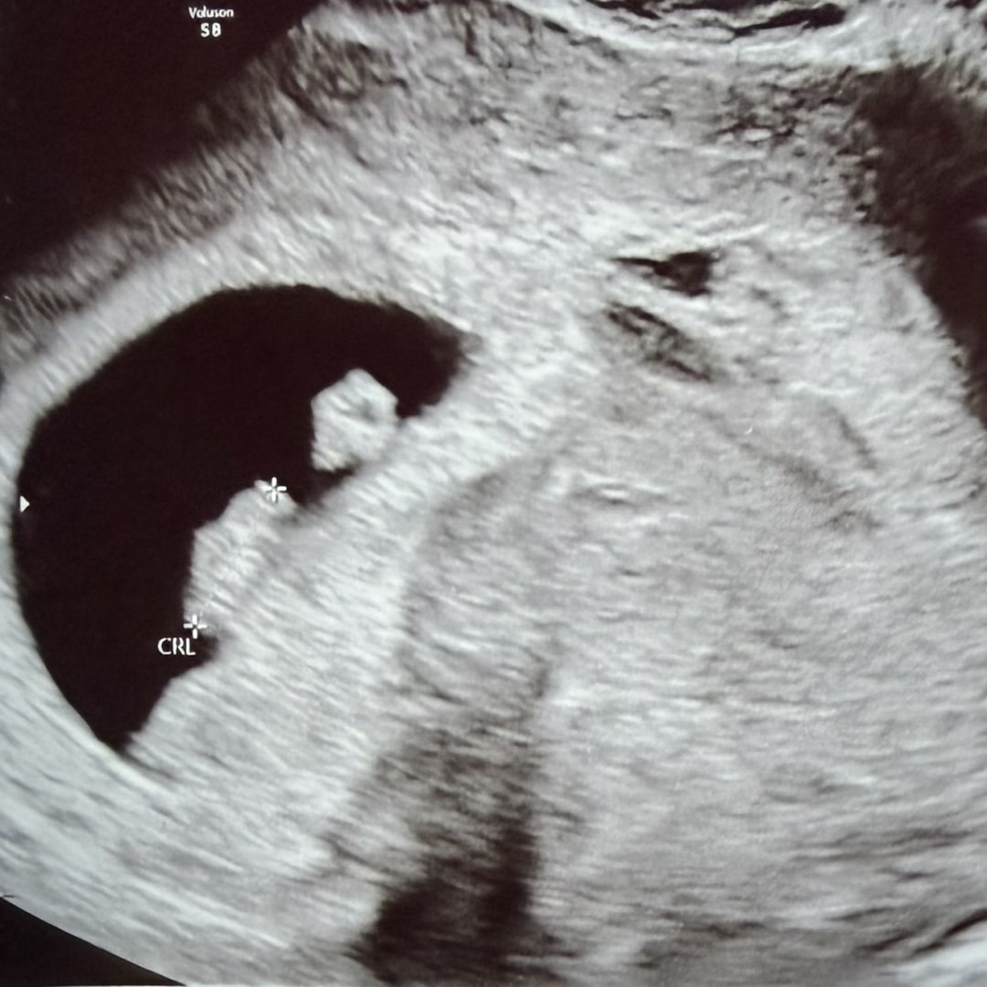 Photo shared by Diana for their Babylist baby registry.