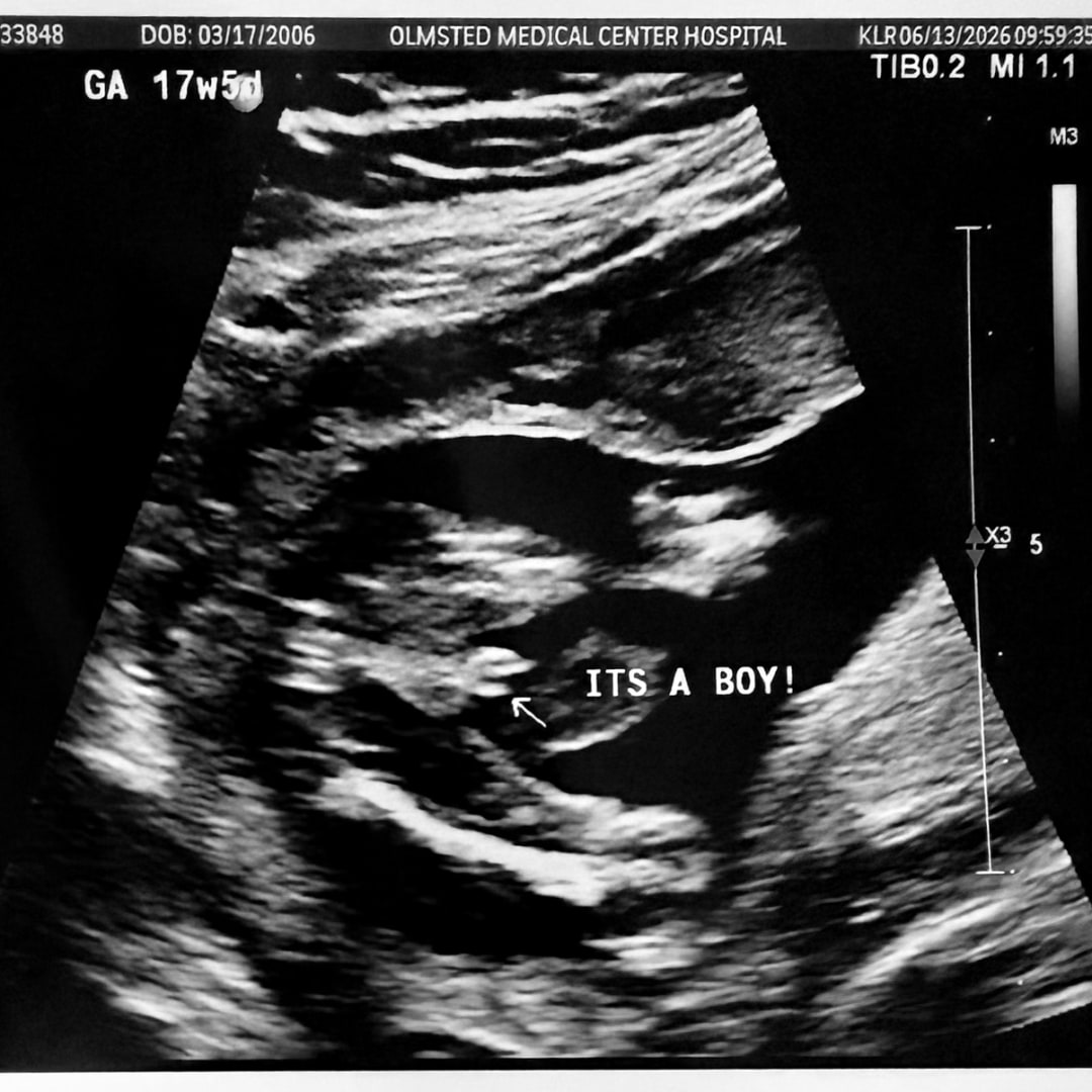 Photo shared by Melody for their Babylist baby registry.