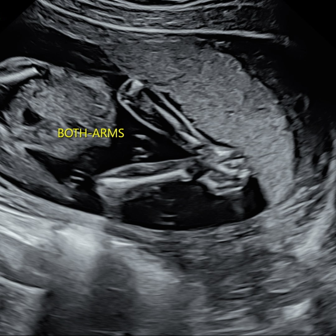 Photo shared by Kirslyn for their Babylist baby registry.