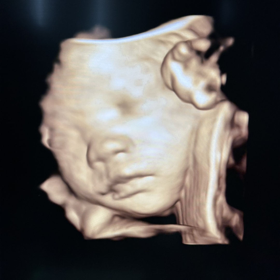 Photo shared by Minhee for their Babylist baby registry.