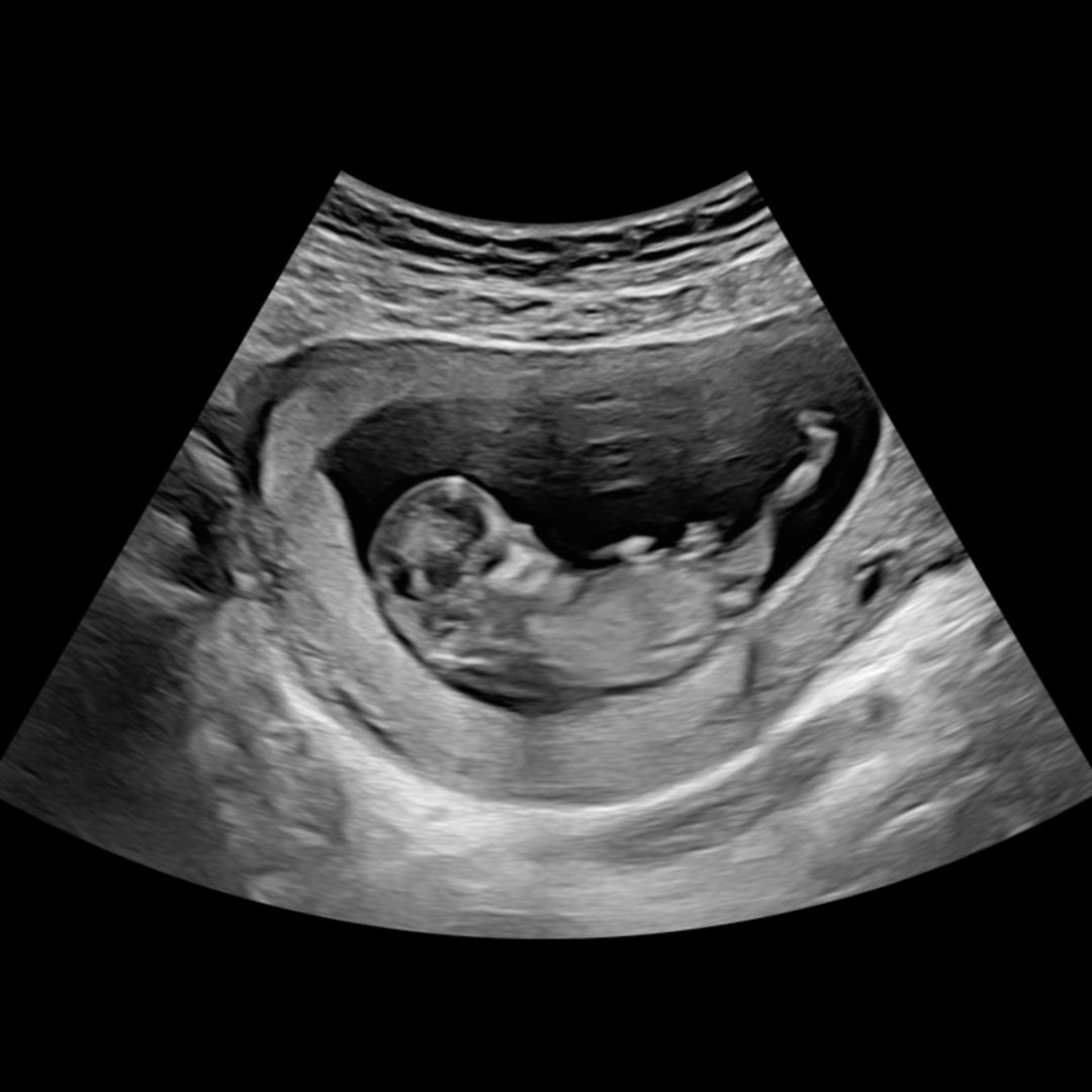 Photo shared by Camila for their Babylist baby registry.
