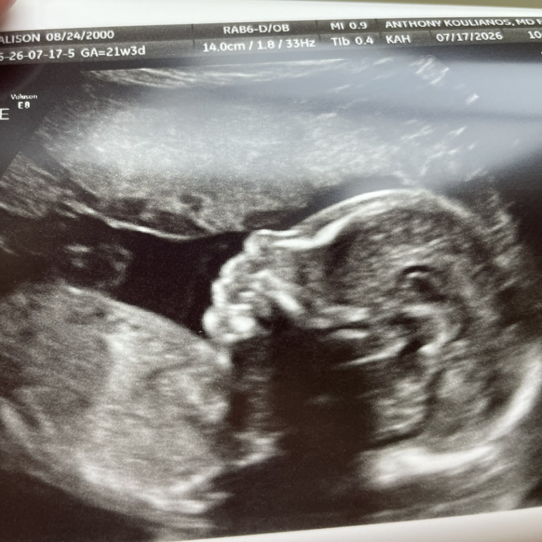 Photo shared by Alison for their Babylist baby registry.