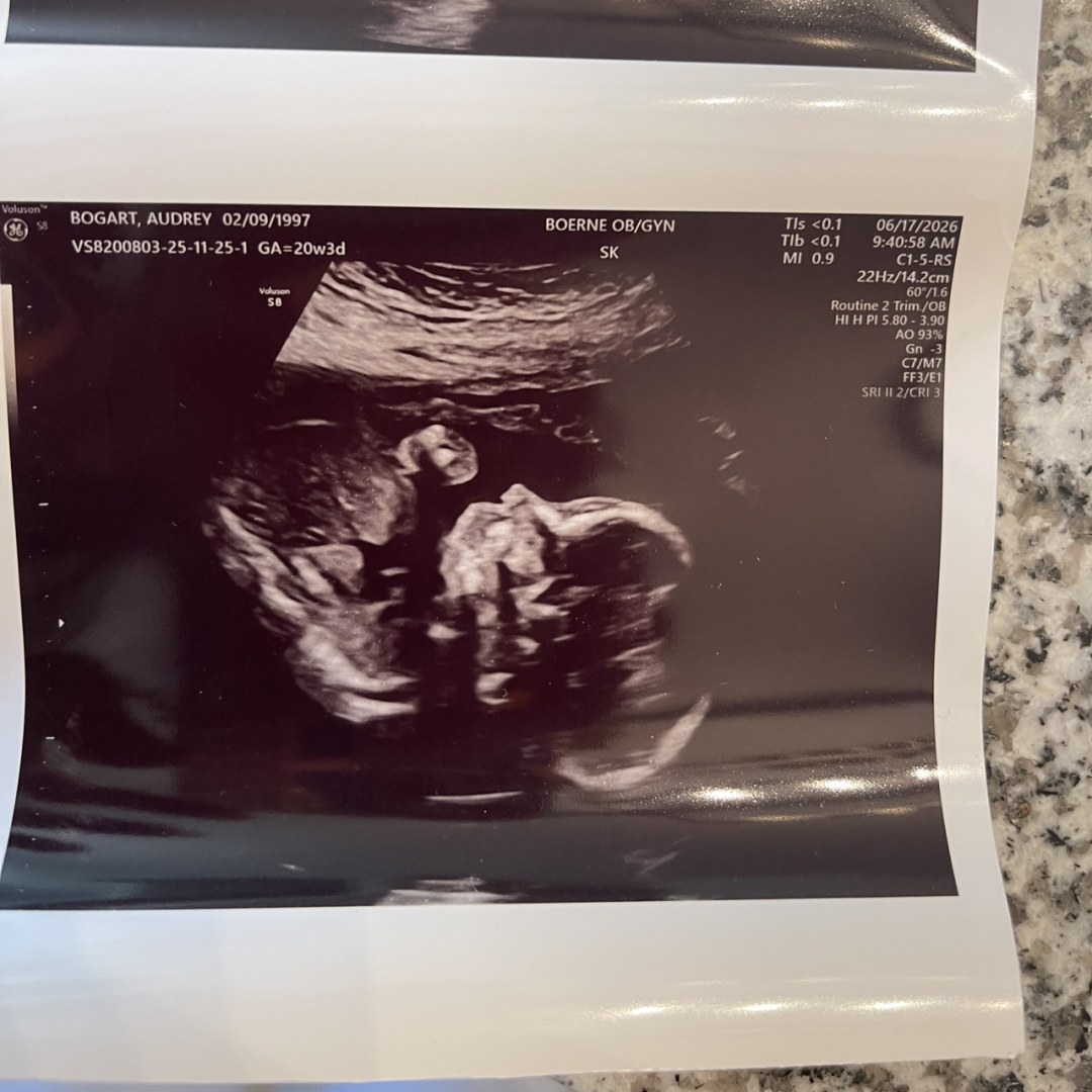 Photo shared by Audrey for their Babylist baby registry.