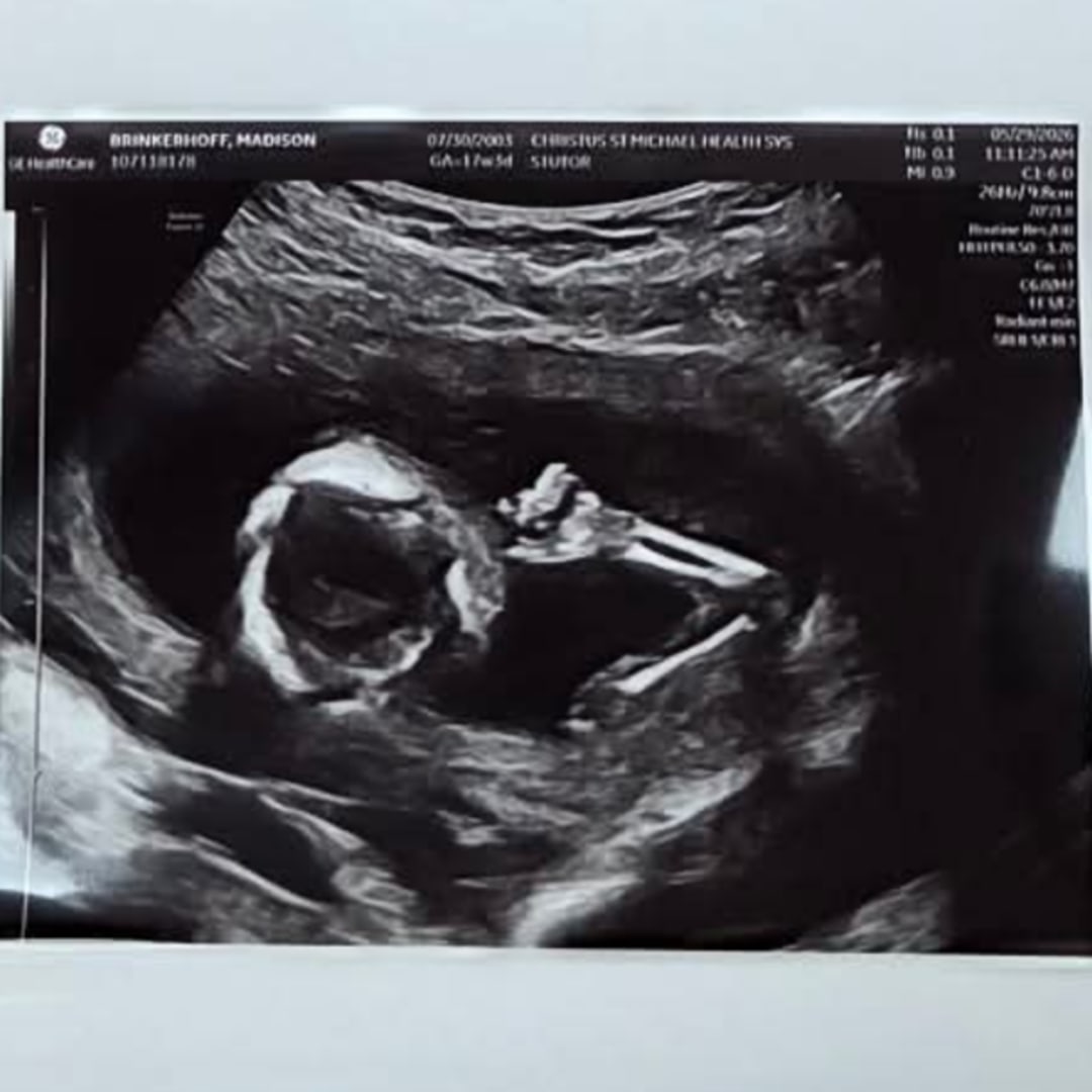 Photo shared by Madison for their Babylist baby registry.