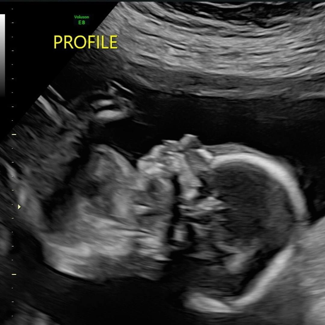 Photo shared by Ashley for their Babylist baby registry.