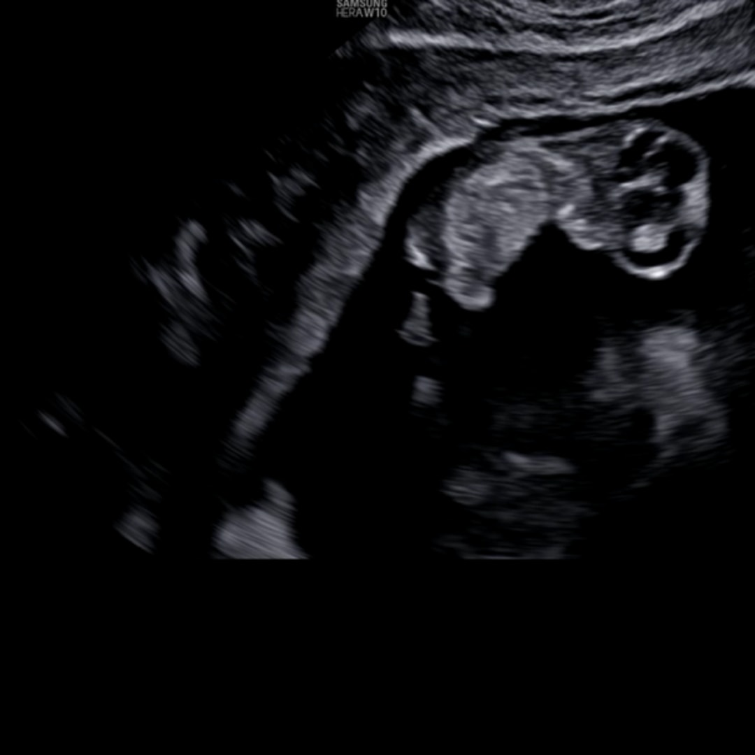 Photo shared by Donneria for their Babylist baby registry.