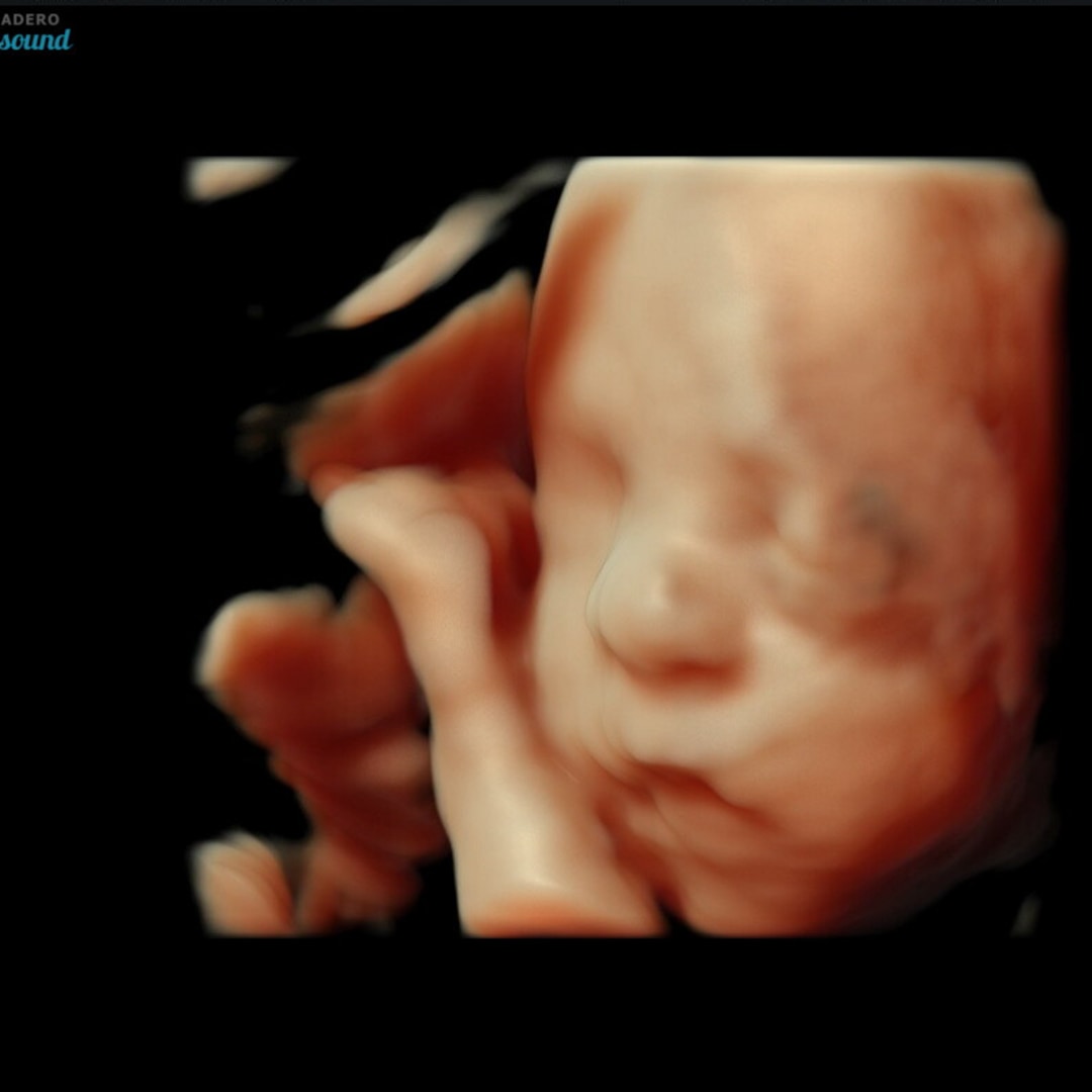 Photo shared by Betzy for their Babylist baby registry.